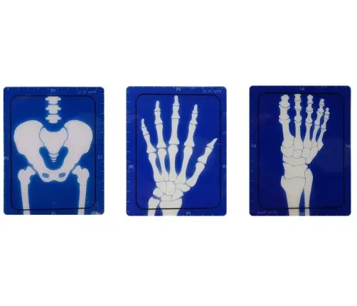 Medical Kit Apparatus Medical Accessories X-ray Doctor Medical Kit Apparatus Medical Accessories X-ray Doctor